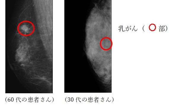 レントゲン写真